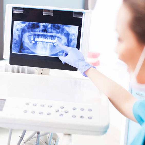 Grandview Denture Clinic : Implant Dentures in Edmonton